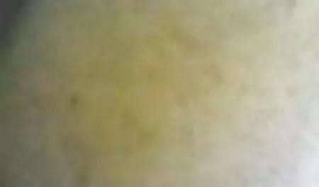 بانداژ در فیلم سوپر ر لباس چرم